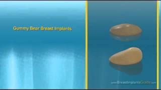 Types of Breast Implants