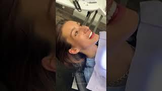 Importance of teeth #looksmaxing  #chad  #jawline  #theeth  #looksmax