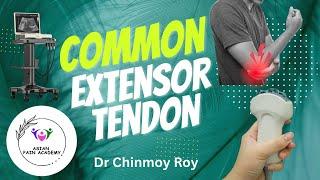 Sonoanatomy of the common extensor tendon of the elbow.