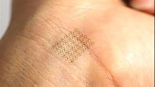 Electronic Bandages or "Bio-patches" are new biomedical technology