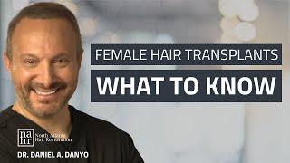 Female Hair Transplants: What to Know