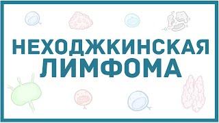 Неходжкинская лимфома - виды, причины, патогенез