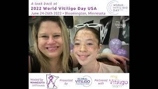 World Vitiligo Day USA 2022