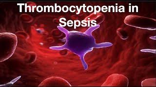 Thrombocytopenia in Sepsis