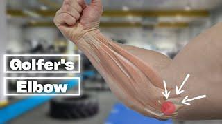 5 BEST Exercises For Golfers Elbow Rehab! [TRY THESE!]