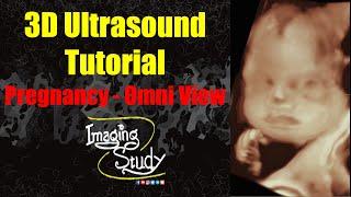 3D Ultrasound Tutorial: Pregnancy | Omni View