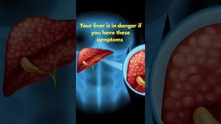 ️Your Liver is in danger if you have these symptoms!!️ #health #liver #knowledge #shortvideo