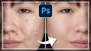 Smooth skin, remove spots & pimples | Special retouching technique in Photoshop