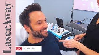 Laser Hair Removal For Men Face and Neck Line