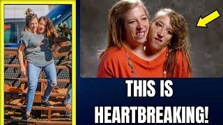 The Heartbreaking Story Of The Conjoined Twins Abby And Brittany!