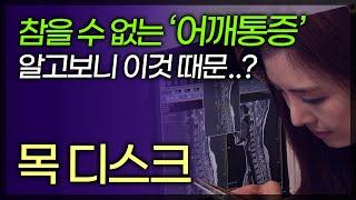 목 디스크! 수술만이 답은 아니다.. 목 디스크, 목 통증을 치료하는 올바른 방법은? / 부산mbc TV닥터인사이드 140711방송