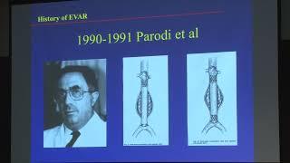 2017 Stanford Aortic Festgraft (Part 2): Early History