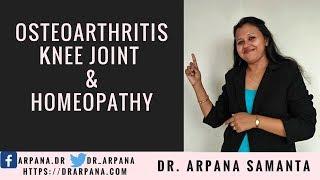 आर्थराइटिस या संधिवात, घुटनों का दर्द, होमियोपैथी दवाई  || OSTEOARTHRITIS Knee Joint & Homeopathy