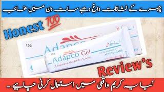 Adapco Gel uses,Side Effects | How to use Adapco Gel |Best product for all types of acne