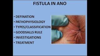 FISTULA IN ANO