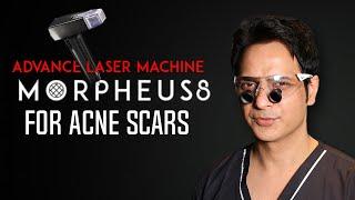 Morpheus 8 Treatment at Kyra Aesthetic Clinic | Advanced Microneedling & Radiofrequency