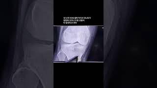 누구에게는 한번사는 인생이지만, 두번 세번 덤으로 사는 고양이들과 나 #shorts
