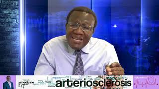 PERIPHERAL ARTERIAL DISEASE—DR. ISAAC OPOKU ASARE