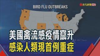 美爆首起人類感染禽流感重症 加州6成乳牛群確診 人類確診數更占全美一半 宣布進入緊急狀態｜非凡財經新聞｜20241220