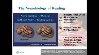 A Hybrid Model for the Assessment of Dyslexia in California