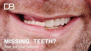 Options For Replacing Missing Teeth | An In Depth Look Reuben Sim