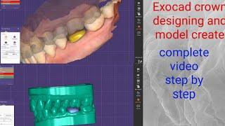 Exocad 3.0 Galway - How to Make Models/#Making Models in Exocad/#Exocad Model creator/#exocad design