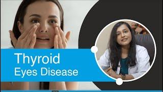 Thyroid Eye Disease | Thyroid Eye Disease Treatment | Dr. Rwituja Thomas Grover