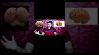 Human Brain Vs Dolphin Brain Vs Shark Brain