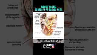 얼굴살 없어도 울쎄라가 꼭 필요한 이유!