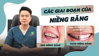 NIỀNG RĂNG SẼ PHẢI TRẢI QUA CÁC GIAI ĐOẠN NÀO?