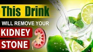 Karma Ayurveda emphasizes Lemon water for Kidney Stones | Karma Ayurveda Hospital