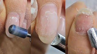 [50sub]드릴제거 힘조절 필수입니다! Remove gel with a drill! Control is essential#nailart #nailcare #셀프네일