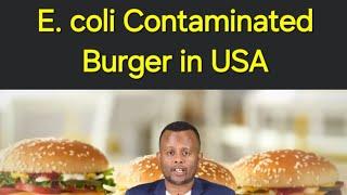 በE. coli ባክቴሪያ የተበከለ በርገር - CDC Report | በአሜሪካ ላላችሁ ከወረርሽኙ ጥንቃቄ አድርጉ | #foodcontamination