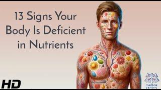 Nutrient Deficiency: 13 Symptoms You Shouldn't Ignore