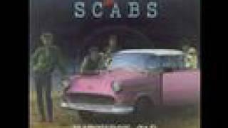 Matchbox Car - the Scabs