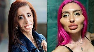 The Strangest People in the World. Documentary