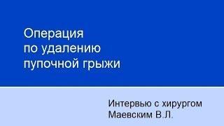 Операция по удалению пупочной грыжи