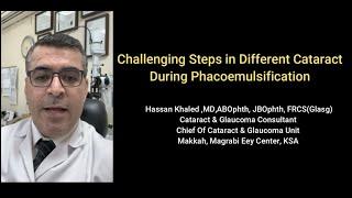 Challenges during Phacoemulsifications