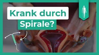 Verursacht die Essure Spirale gesundheitliche Probleme? Sterilisation | Verhütung | Pharma