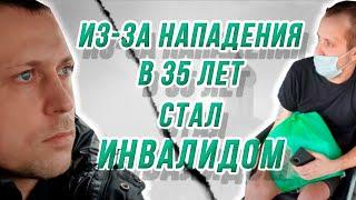 Из-за нападения в 35 лет стал инвалидом!