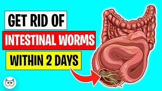 Use These Natural Methods To Get Rid of Intestinal Worms Within Two Days