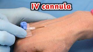 شاهد وتعلم طريقة تركيب الكانيولا _ IV cannulation procedure