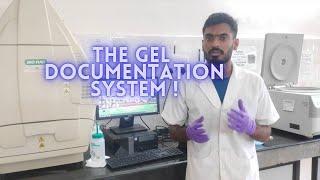 Analysis of gels in gel documentation system !!!