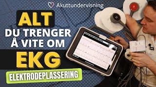 Hvordan ta et EKG? Rett elektrodeplassering!