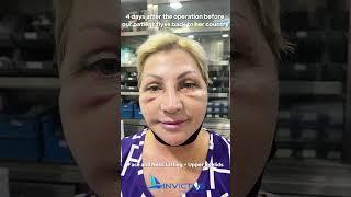 Face Aesthetic Surgery in Turkey!  #healthtourismagency #faceneckliftsurgery #facelift #necklift