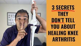 Top 3 Secret Ways To Slow Down And Even Stop Knee Arthritis Progression