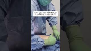 What are the benefits of MLE™ (Manual Lipedema Extraction™)? We get this question a lot, so here’s a