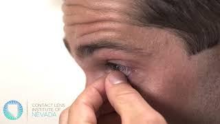 How to remove a hybrid contact lens