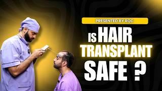 Hair Transplant is SAFE procedure or NOT? | In Hindi | Best Hair Transplant Doctor in India