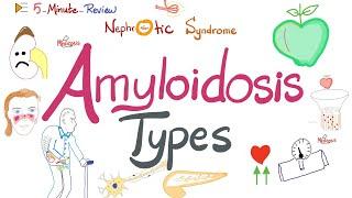 Amyloidosis Types - Pathology  |  Quick Review